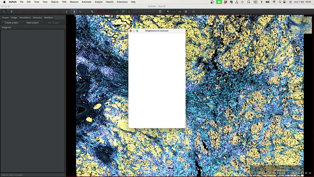 Efficient Channel Extraction in QuPath: Script Showcase