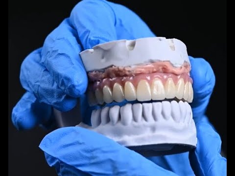 Dantura fixa in 48h - Evodent Clinic Timisoara