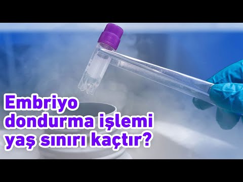 Embriyo dondurma işlemi için yaş sınırı ve uygulama sınırı kaçtır?