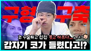코 수술 후 점점 붓고 들린다면? 구형구축 신호일 수 있습니다