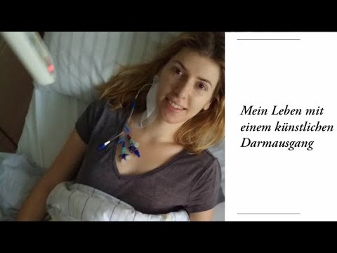 Künstliche Darmausgang: Mara geht's besser + Kock-Pouch Entleerungs-Anleitung - Colitis Ulcerosa