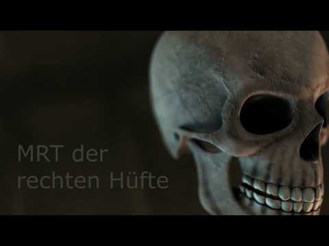 Die Schmerzen im Rücken lindern und gibt auf Dikul Behandlung von Wirbelsäulen Hernie