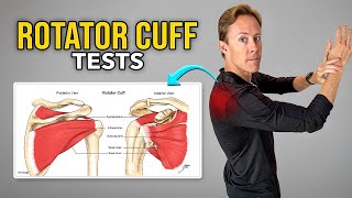 Is Your Shoulder Pain From the Rotator Cuff? Try These Tests