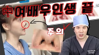 [재업로드][Dr.허니팁]#코성형​ 부작용 최악 Of 최악 !