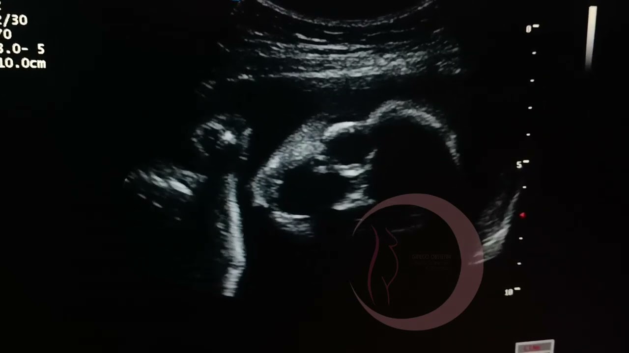 Jesús Sánchez Carrasco-30