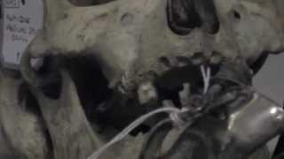 Team Sleep - Your Skull Is Red