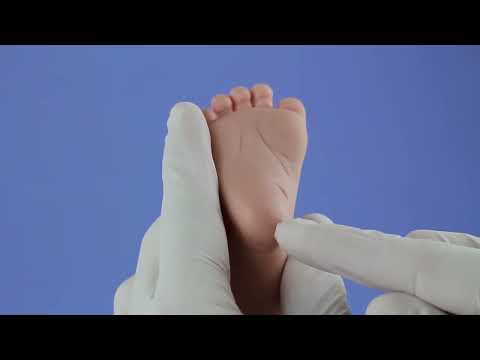 How to Use babyLance™ Safety Heelsticks | Step-by-Step Guide