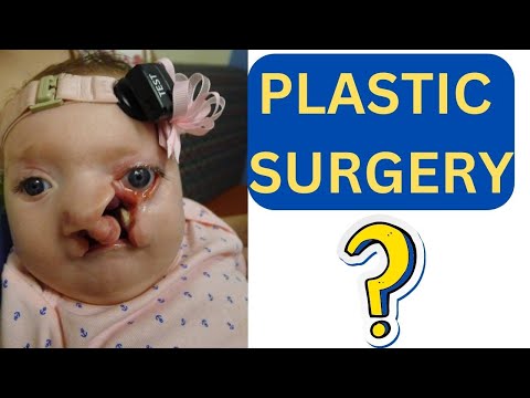 30 Crazy Facts About Plastic Surgery
