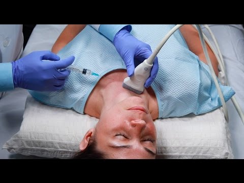 Ultrasound Guided Fine Needle Aspiration (UGFNA) - Anagh Vora, MD