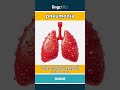 pneumonia - a bad lung infection that... video thumbnail