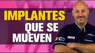 ⚠️ ¿Por qué se mueven los implantes dentales ⚠️ Sientes que tu implante está flojo o se mueve