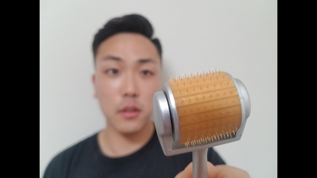 AVOID 5 MICRONEEDLING MISTAKES FOR HAIR GROWTH!