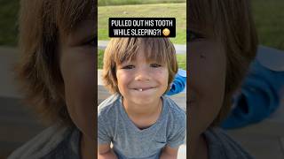 PULLED HIS TOOTH OUT WHILE SLEEPING?!