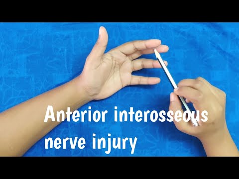 Anterior interosseous nerve injury/ok sign/sign of benediction