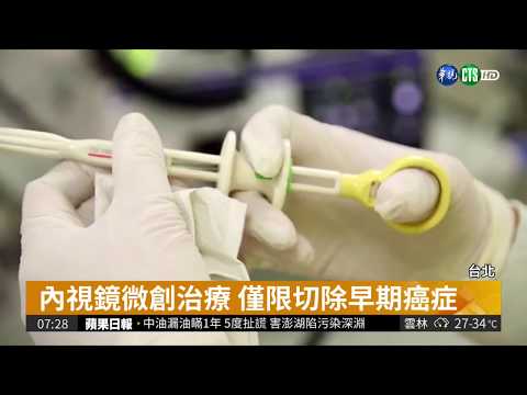 內視鏡微創治療 減少手術風險