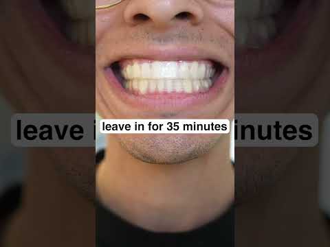 How to whiten your teeth at home!