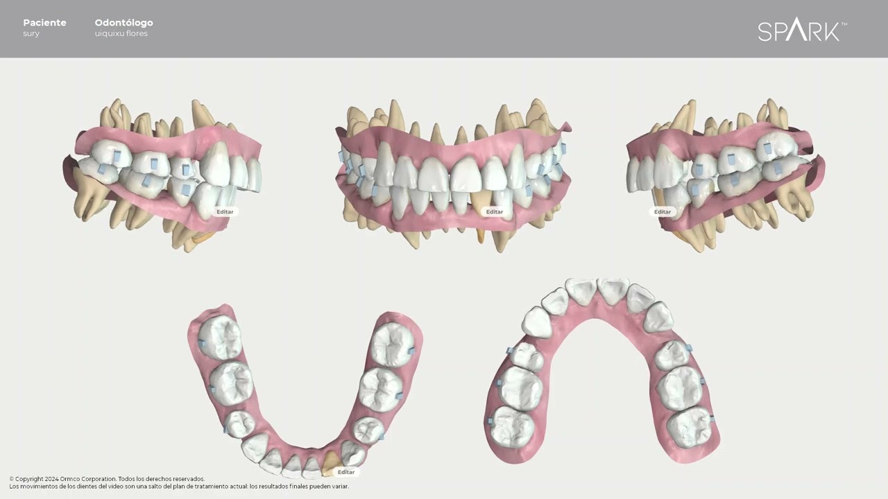 Uiquixu Flores Castro-13