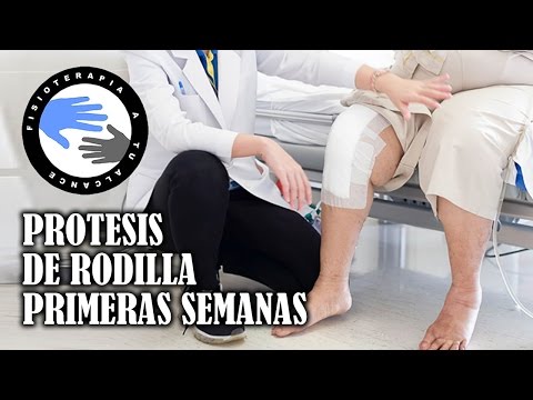 Tratamiento de la columna vertebral ejercicios en casa Espondilitis tuberculosa de la columna Tratamiento