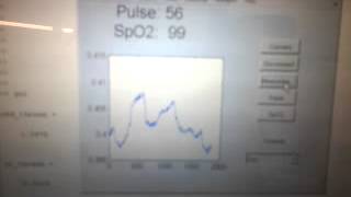OSU ECE Senior Design Group 25 Battery Test Part 1