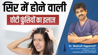 Causes & Treatment of Scalp Pimples | Why Scalp Acne Occurs ? | Dr Mukesh Aggarwal