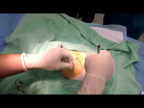 動物用胸腔穿刺導管