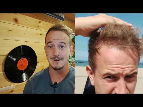 The truth about Dr Cinik clinic | 1 year review after hair transplant | Cheap hair transplant turkey