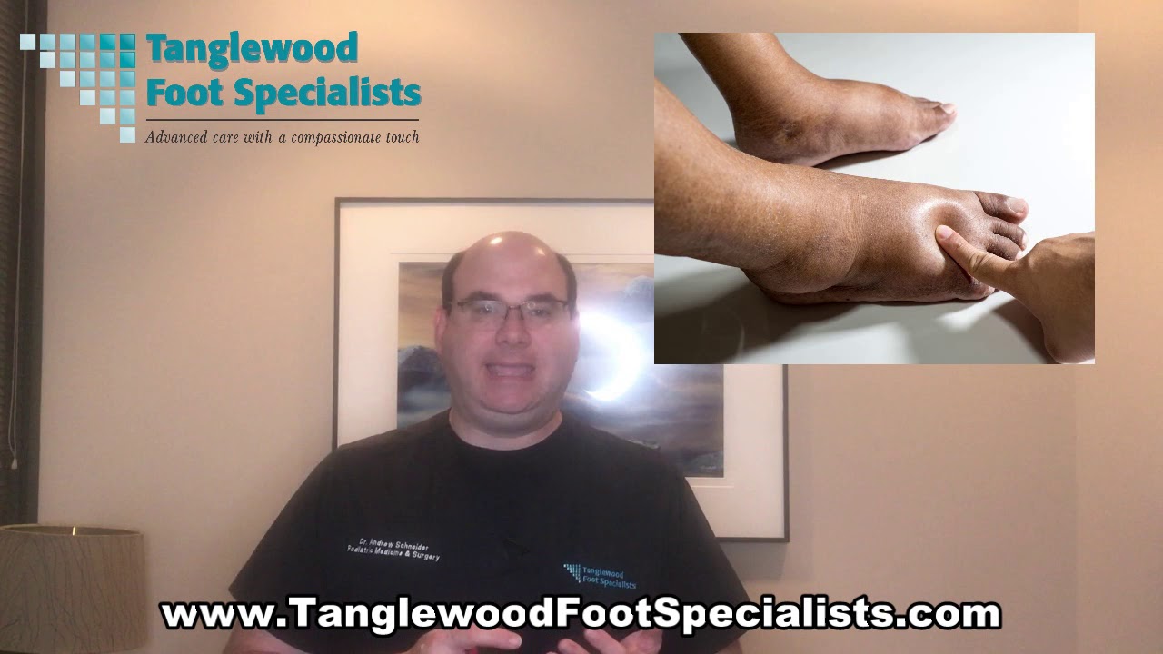 What's Causing Swelling in Your Foot and Ankle?
