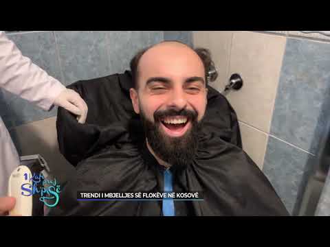 1 Kafe prej Shpisë - Trendi i mbjelljes së flokëve në Kosovë 21.02.2021