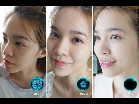 ม้าซื้อเชื้อโรคในมอสโก ทิงเจอร์ค้อนของ ธ อร์
