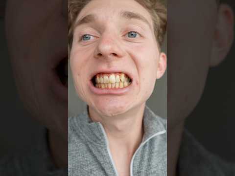 I Fixed My Rotting Teeth
