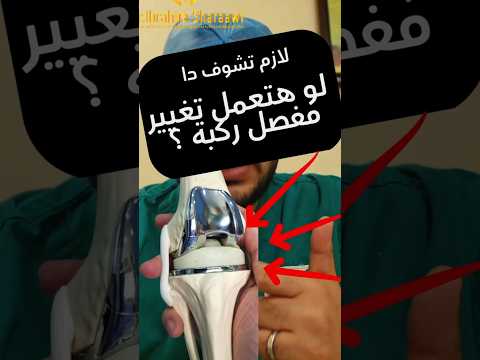 انواع مفصل الركبة الصناعي