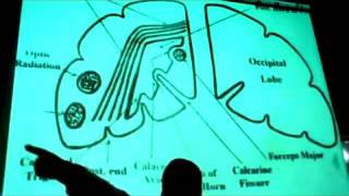 Dr. Ehab - Lateral Ventricle (2)