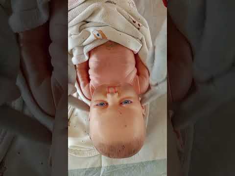 Examination of a new born baby