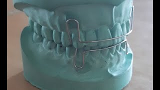Download lagu Short Labial Bow Fabrication with Indications-Method 1 |Removable Orthodontic Appliance|Orthodontics mp3