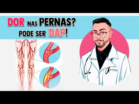 Doença Arterial Periférica (DAP) │ Fisiopatologia da Aterosclerótica