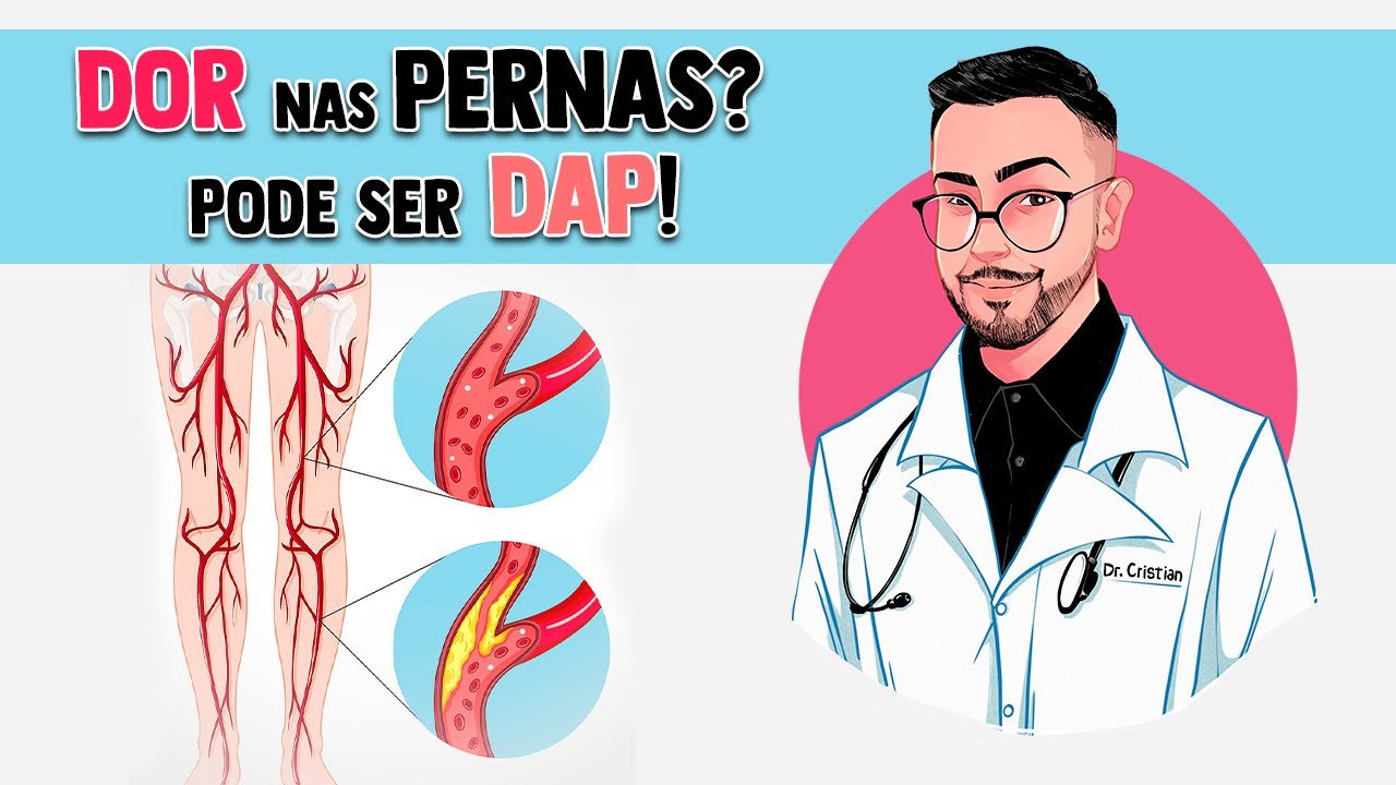 Doença Arterial Periférica (DAP) │ Fisiopatologia da Aterosclerótica