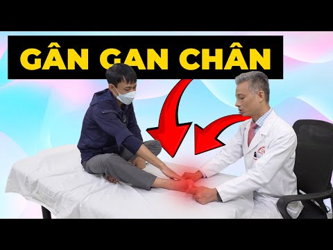 VIÊM GÂN GAN BÀN CHÂN: Tại Sao Đau Nhói Mỗi Bước Chân Và Cách Chữa Dứt Điểm