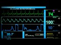 Sonido De Un Hospital