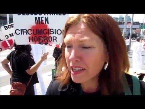 Doctor Says Circumcision Not Required