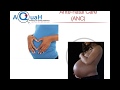 PMTCT ANC Care 11April2018