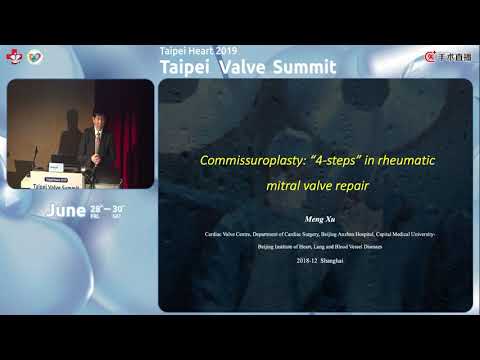 Taipei Valve Summit 2019 06 28 AM