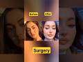 Pakistan Actress Before And After Surgery Surgery Mahirakhan Pakistaniactresses Durefishan
