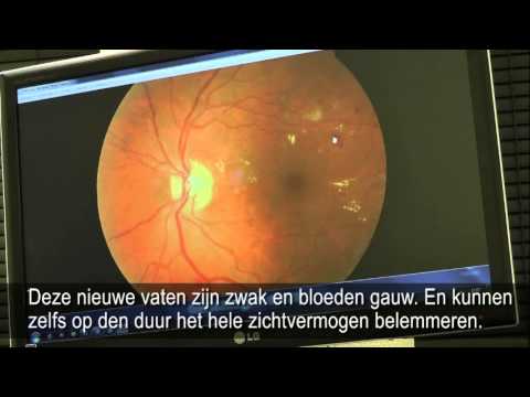 Möglich-ob Granaten für Diabetiker haben Kann ich Vision bei Diabetes wiederherstellen