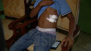 Joven agredido en liceo de Villa Mella se encuentra estable y en su vivienda