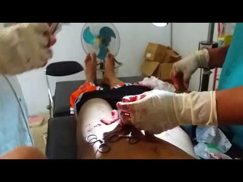Obat-obatan untuk meningkatkan potensi pada pria tanpa efek samping forum Penyakit ginjal mempengaruhi potensi