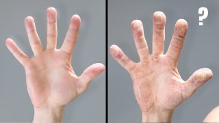 I Conditioned My Finger Tips For Months - IRON FINGERS