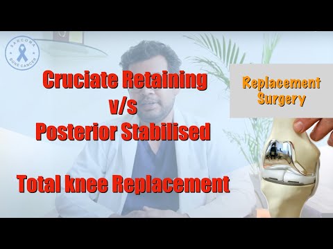 Cruciate Retaining vs. Posterior Stabilised Total knee Replacement, Which is better? Dr Deepak Garg