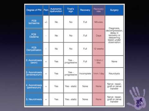1 minute masterclass: Management of nerve injury by grade