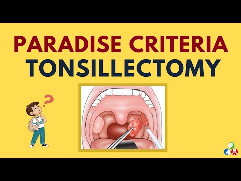 Paradise Criteria for Tonsillectomy | ENT Viva Voce