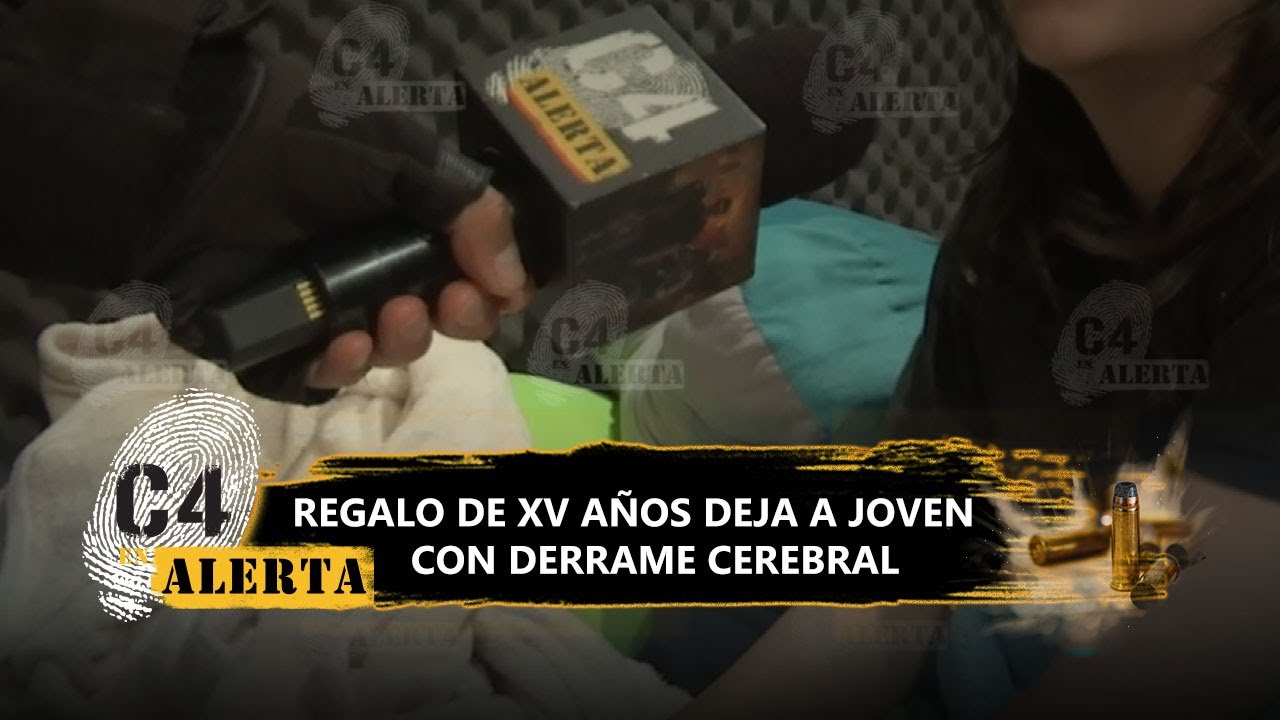 Por XV años, regalan una rinoplastia a joven y le causan derrame cerebral en clínica de CdMx